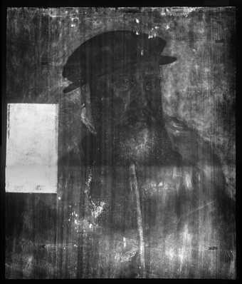Fig.2 X-radiograph of An Unknown Man in a Black Cap