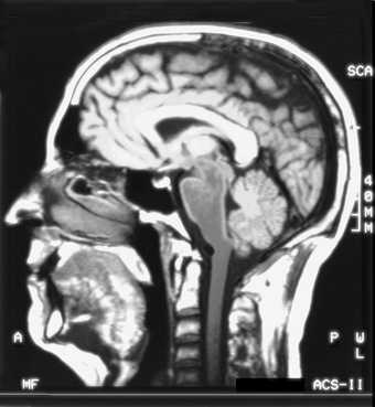 Head sagittal section MRI scan from Neuroarthistory From Aristotle and Pliny to Baxandall and Zeki image of a scan of a human head in cross section