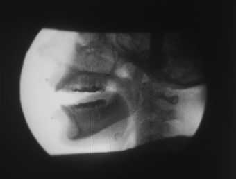 Ana Mendieta X-ray c.1975, film still. Copyright The Estate of Ana Mendieta Collection, L.L.C. Courtesy Galerie Lelong & Co. and Alison Jacques Gallery