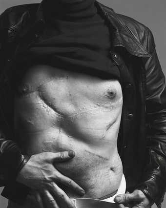 Black and white photograph of Andy Warhol's torso with scar across it 