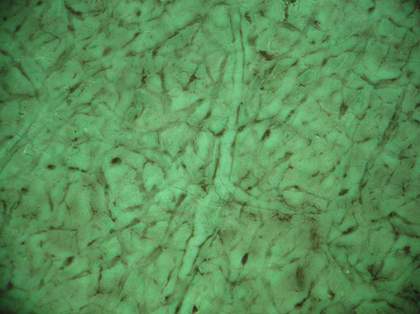 Johan Zoffany's Charles Macklin as Shylock, detail of paintwork for Tate conservation project