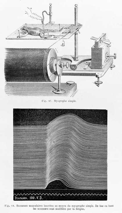 Simple myograph (top) and trace of repeated muscular contractions (bottom). From Etienne-Jules Marey, La Méthode graphique