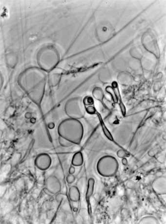 Photograph of streptobacillus moniliformis through a microscope, found among the papers of Nigel Henderson in the Tate archive