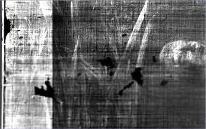 X-ray of Ophelia